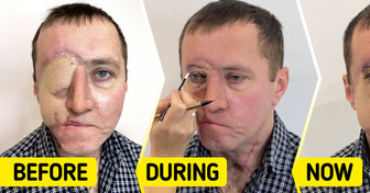 Tattoo Artist Uses Her Skills to Give a Man a “New Permanent Eye” After a Horrific Car Accident