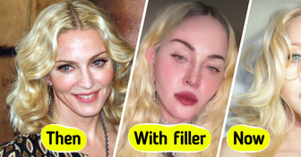 Madonna, 67, Debuts with a “NEW FACE”, Fans Are Speechless