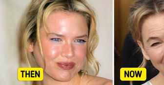 Renée Zellweger’s Lips Look Unusual, and Everyone Wants Answers