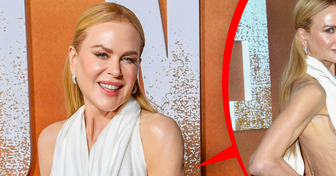 “No One Wants to See It,” Nicole Kidman Rocks Cheeky Dress on Red Carpet, but People Labeled It “Too Daring”