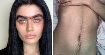 These 15 Women Show That Body Hair Is Nothing to Hide