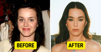 18 Stars Who Openly Talked About Plastic Surgery