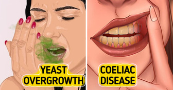 15+ Alarming Signals Your Body Is Begging You Not to Ignore