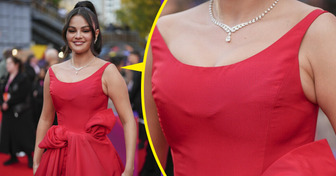 "What Is Going On With Her Arms?" Selena Gomez's Appearance Raised Many Questions