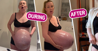 “That’s My Nightmare,” Mom’s Enormous Baby Bump That Sticks “Straight Out” Leaves People Speechless