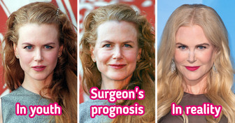 Plastic Surgeon Reveals What Celebrities Would Look Like if They Aged Like Regular People