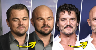 We Imagined 14 Celebrities Bald — And the Results Are Really Impressive