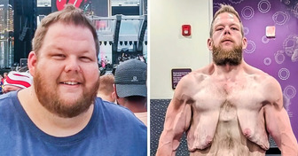 Man’s Remarkable 360 Pound Weight Loss Journey Has Everyone Talking