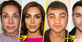 Plastic Surgery With a Mysterious Formula — The Results Are Shocking