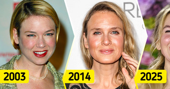 10 Celebrities Who Have Dramatically Changed as They Got Older