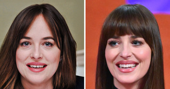 14 Celebrities Who Prove That Teeth Makeovers Can Completely Redefine Your Look