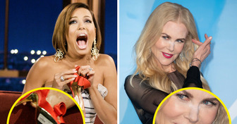 10 Stars Who Handled Unexpected Spotlight Moments Like Total Pros