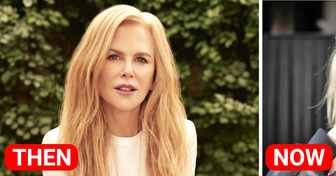 «Her Real Face Is Totally Gone!» Nicole Kidman Shared Completely New Look and Hit Fans to the Heart
