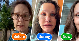Woman, 50, Reveals Plastic Surgery Results, Leaving People Speechless With Her Strikingly Youthful Look