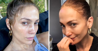 Dermatologist Revealed the Secret to Why 54-Year-Old J. Lo Looks Incredibly Young Without a Drop of Botox