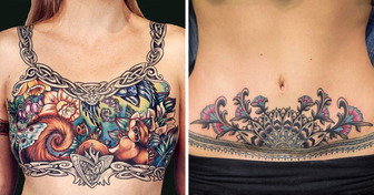 15 People Who Used Tattoos to Turn Their Scars and Birthmarks into Art