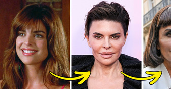 6 Celebrities Who Honestly Share Their Plastic Surgery Experiences