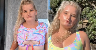 “Girl Who Can’t Smile” Turns Her Unique Story Into Modeling Success, Proving That Beauty Has No Rules