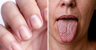 15 Unexpected Body Changes That Prove You’re Aging Exactly As You Should
