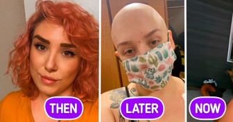 13 Inspiring Pictures of People Who Refused to Give Up on Life