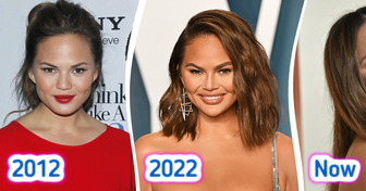 “What’s Up with Her Face?” Chrissy Teigen Gives a Witty Response to People Who Accuse Her of Having “Too Much Filler”