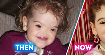 “Voldemort” Baby Grew Up — What She Looks Like Today Will Shock You