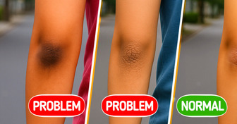 10 Health Problems Your Elbows Might Be Trying to Warn You About
