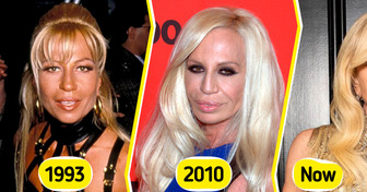 10 Celebrities Who Look Completely Different Than They Used To