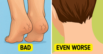 10 Alarming Clues Your Body Might Be Reacting to Blood Sugar Spikes