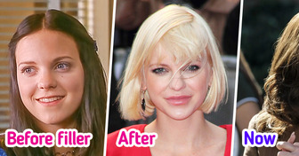 Anna Faris, 47, Dissolved Fillers in Her Face, Leaving People in Awe