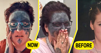 A Woman’s Face Was Marked Against Her Will — But She’s Finally Getting It Removed