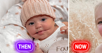 Baby Girl With a Rare Smile Grew Up — What She Looks Like Today Will Leave You Speechless