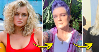 “What a Shame!” The Baywatch Star Shocked with Her New Appearance