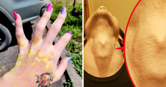 16 People With Unique Body Features You Don’t See Every Day