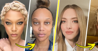 15 Stars Who Went Unfiltered to Show They’re Human Too