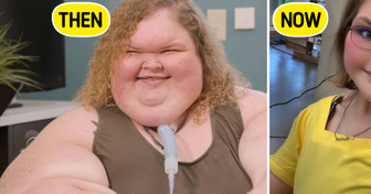 “1,000-lb Sisters” Star Reveals Remarkable 400-Pound Weight Loss and Skin Surgery