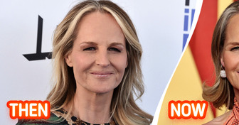 Helen Hunt, 60, Leaves People Speechless During Rare Outing, with Her Lips Stealing the Spotlight