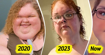 “1000-lb Sisters” Star Reveals Stunning New Look After Skin Removal Surgery, Leaving People in Awe