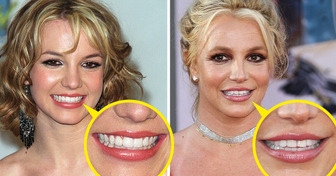 What Happened to Britney Spears: Pop Icon’s Rollercoaster Life Including Teeth Gap Theories and Social Media Breaks