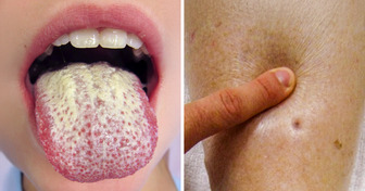 7 Non-Obvious Signs Your Body May Be Using to Scream for Help