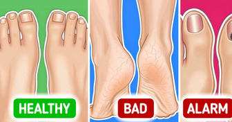 Your Feet Are Trying to Tell You Something: 5 Troubling Health Signs You Shouldn’t Ignore