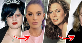 10 Celebrities Who Look Nothing Like They Used To