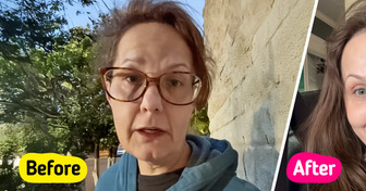 Woman, 50, Reveals Her Remarkable Plastic Surgery Results, Sparking Major Buzz Online