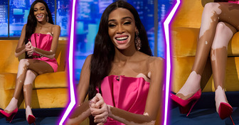 Meet Winnie Harlow, a Vitiligo Supermodel Winning Against Beauty Stereotypes
