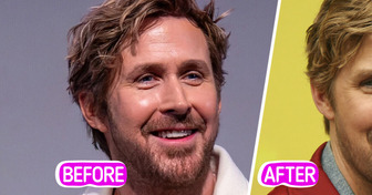 “I Would Not Even Recognize Him!” Gosling’s Puffy Cheeks Trigger PLASTIC SURGERY Debate