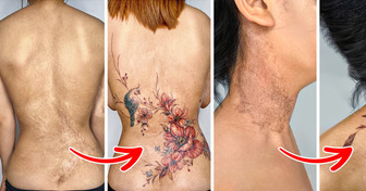 A Vietnamese Tattoo Artist Gives People Beauty and Confidence by Hiding Their Scars Under Her Designs