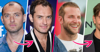 12 Celebrity Heartthrobs Before and After They Allegedly Got Hair Transplants