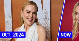 Nicole Kidman, 57, Stuns on the Red Carpet, But Her Look Sparks Controversy Over One Detail