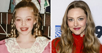 How 14 of Our Favorite Stars Looked Before They Reached Megastardom