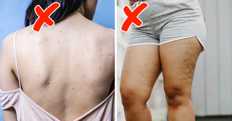 8 Not Obvious Health Effects of Wearing Clothes That Are Too Tight